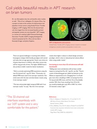 Dr. van Zijl explains that the coil benefits other studies
as well. “One of our colleagues, Dr. Jinyuan Zhou, has
a project to look at the content of small proteins and
peptides in brain tumors using Amide Proton Transfer
imaging, or APT imaging. With the 32-channel head
coil, the images from the increased baseline protein
and peptide content are very beautiful.” APT imaging
is a variant of a method called Chemical Exchange
Saturation Transfer (CEST) imaging developed for
research purposes by Drs. Zhou and van Zijl at
Kennedy Krieger and Johns Hopkins.
References
1 Mori, S., Wakana, S., Poetscher, N. L. M, van Zijl, P. C. M.
MRI Atlas of Human White Matter, First Edition.
Elsevier Science. (2005).
2 Zhou J, Blakeley J, Hua J, Kim M, Laterra J, Pomper M, van Zijl PCM.
A practical data acquisition method for human brain amide proton
transfer (APT) imaging.
Magn Reson Med. 2008 Oct; 60(4):842-9.
There are special challenges in working with children.
Investigators design child-friendly paradigms with stimuli
and tasks that are age appropriate. Faster scan times are
of great importance in children, who often cannot stay
still for long periods of time. The higher SENSE factors
also produce smaller voxels for better localization.
“We’re currently optimizing fMRI acquisitions using the
new 32-channel coil,” says Dr. Pekar. “Previously, our
default fMRI exam used 3 mm isotropic resolution. Our
initial scans with the new coil show better results using
2 mm isotropic voxels.”
“The new coil provides higher temporal SNR with 3 mm
isotropic voxels,” he says, “But the 2 mm isotropic
“The 32-channel coil
interfaces seamlessly with
our 3.0T system and is very
comfortable for the patient.”
Coil yields beautiful results in APT research
on brain tumors
voxels show higher t-values in a block-design activation
paradigm, which is due to reduced partial volume effects
when using smaller voxels.”
Increasing to more than 32 coil elements will add
less benefit
“Adding even more coil elements will not have a similar
impact as moving from 8 to 32,” says Dr. van Zijl. “There’s
a point of diminishing gain per added coil element as this
follows an exponential curve. Changing from 1 to 8 will
give more than a doubling in SNR, increasing from 8 to
16 may provide 50% more, and from 16 to 32 probably
another 10%. Even if you would go from 32 to 64,
you would probably gain only 10% in SNR. So, I think
32 channels is about right.”
Tumor core
Peritumoral
edema
APT of oligodendro-astrocytoma
Amide Proton Transfer (APT) imaging contrast is based on increased
endogenous cytosolic proteins and peptides in tumor core.
FieldStrength – Issue 39 – December 200918
 