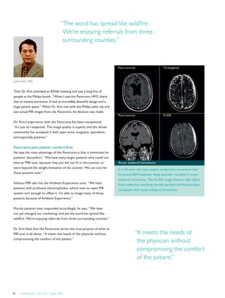 Post contrast T2-weighted
Post contrast FLAIR
Acute subdural hematoma
In a 64-year-old male violent involuntary movement due
to severe REM behavior sleep disorder resulted in acute
subdural hematoma. The FLAIR image shows a high signal
fluid collection overlying the left parietal and frontal lobes
consistent with acute subdural hematoma.
Then Dr. Kim attended an RSNA meeting and saw a long line of
people at the Philips booth. “When I saw the Panorama HFO, there
was an instant attraction. It had an incredibly beautiful design and a
huge patient space.” When Dr. Kim met with the Philips sales rep and
saw actual MR images from the Panorama, his decision was made.
Dr. Kim’s experience with the Panorama has been exceptional.
“It’s just as I expected. The image quality is superb, and the whole
community has accepted it with open arms; surgeons, specialists,
and especially patients.”
Panorama puts patient comfort first
He says the main advantage of the Panorama is that it minimizes his
patients’ discomfort. “We have many larger patients who could not
have an MRI scan, because they just did not fit in the scanner, or
were beyond the weight limitation of the scanner. We can care for
those patients now.”
Solstice MRI also has the Ambient Experience suite. “We have
patients with profound claustrophobia, where even an open MR
system isn’t enough to offset it. I’m able to image many of those
patients because of Ambient Experience.”
Florida patients have responded accordingly, he says. “We have
not yet changed our marketing, and yet the word has spread like
wildfire. We’re enjoying referrals from three surrounding counties.”
Dr. Kim feels that the Panorama serves the true purpose of what an
MR scan is all about. “It meets the needs of the physician without
compromising the comfort of the patient.”
“The word has spread like wildfire.
We’re enjoying referrals from three
surrounding counties.”
“It meets the needs of
the physician without
compromising the comfort
of the patient.”
FieldStrength – Issue 38 – August 200932
Lance Kim, MD
 