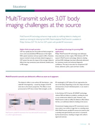 FieldStrength 35
MultiTransmit solves 3.0T body
imaging challenges at the source
MultiTransmit RF technology enhances image quality by nullifying dielectric shading and
speeds up scanning by reducing local SAR. Patient-adaptive MultiTransmit is available on
Philips’ Achieva 3.0T TX, the first 3.0T system with parallel RF transmission.
Educational
Higher field strength paradox
3.0T has rapidly become the preferred field strength for
neuro and musculoskeletal MRI because of the higher
SNR, spatial resolution and scan speed it offers. However,
anyone involved in body and body-related imaging on a
3.0T system has seen the impact of the stronger dielectric
effects that may sometimes cause darkened, shaded areas
in MR images.
RF source
RF source
Non-uniform Uniform image
Standing
wave
MultiTransmit: parallel RF transmission from two well-tuned RF sources results
in a uniform signal distribution.
The dielectric effect is non-uniform RF distribution – also
called B1 inhomogeneity – caused by changes of the RF
wave due to the tissue’s properties. The effect is more
pronounced at 3.0T than at lower field strengths, as the
RF wavelength at 3.0T (about 25 cm), approaches the
size of the body. Depending on the size, shape and tissue
characteristics of each individual patient, it can result in
standing waves.
In the Achieva 3.0T X-series, RF-SMART technology
reduces SAR and dielectric problems, avoiding the need
to use cumbersome dielectric pads. However, only
MultiTransmit is able to nullify the dielectric effect before
the fact, as it addresses dielectric shading at the source.
Conventional imaging using one RF transmission source
may create a non-uniform image due to a standing wave.
With MultiTransmit, parallel RF sources are tuned so that
a standing wave generated by one source is countered
by the second source, resulting in images with uniform
signal and contrast.
An enabling technology for growing MRI
applications
Philips’ MultiTransmit RF technology now addresses
these obstacles at their origins. With Achieva 3.0T TX
system’s MultiTransmit technology, dielectric shading
and local SAR challenges have been effectively addressed,
for consistent results and enhanced diagnostic
confidence. The way is now clear for exceptional 3.0T
breast, abdomen, pelvis, spine and heart studies.
MultiTransmit cancels out dielectric effect as soon as it appears
 