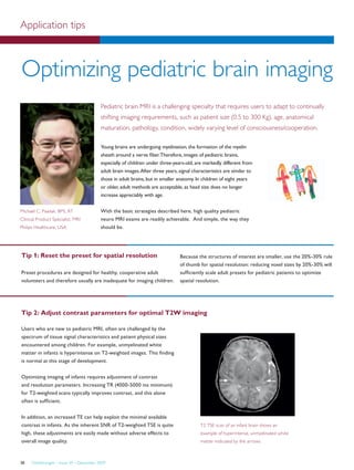 FieldStrength – Issue 39 – December 200938
Application tips
Optimizing pediatric brain imaging
Pediatric brain MRI is a challenging specialty that requires users to adapt to continually
shifting imaging requirements, such as patient size (0.5 to 300 Kg), age, anatomical
maturation, pathology, condition, widely varying level of consciousness/cooperation.
Michael C. Pawlak, BPS, RT
Clinical Product Specialist, MRI
Philips Healthcare, USA
Young brains are undergoing myelination, the formation of the myelin
sheath around a nerve fiber.Therefore, images of pediatric brains,
especially of children under three-years-old, are markedly different from
adult brain images.After three years, signal characteristics are similar to
those in adult brains, but in smaller anatomy. In children of eight years
or older, adult methods are acceptable, as head size does no longer
increase appreciably with age.
With the basic strategies described here, high quality pediatric
neuro MRI exams are readily achievable. And simple, the way they
should be.
Tip 1: Reset the preset for spatial resolution
Preset procedures are designed for healthy, cooperative adult
volunteers and therefore usually are inadequate for imaging children.
Tip 2: Adjust contrast parameters for optimal T2W imaging
Because the structures of interest are smaller, use the 20%-30% rule
of thumb for spatial resolution: reducing voxel sizes by 20%-30% will
sufficiently scale adult presets for pediatric patients to optimize
spatial resolution.
Users who are new to pediatric MRI, often are challenged by the
spectrum of tissue signal characteristics and patient physical sizes
encountered among children. For example, unmyelinated white
matter in infants is hyperintense on T2-weighted images. This finding
is normal at this stage of development.
Optimizing imaging of infants requires adjustment of contrast
and resolution parameters. Increasing TR (4000-5000 ms minimum)
for T2-weighted scans typically improves contrast, and this alone
often is sufficient.
In addition, an increased TE can help exploit the minimal available
contrast in infants. As the inherent SNR of T2-weighted TSE is quite
high, these adjustments are easily made without adverse effects to
overall image quality.
T2 TSE scan of an infant brain shows an
example of hyperintense, unmyelinated white
matter indicated by the arrows.
 