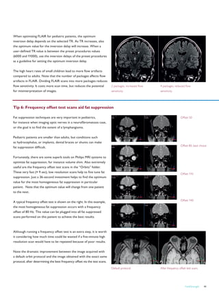 FieldStrength 41
Tip 6: Frequency offset test scans aid fat suppression
Fat suppression techniques are very important in pediatrics,
for instance when imaging optic nerves in a neurofibromatosis case,
or the goal is to find the extent of a lymphangioma.
Pediatric patients are smaller than adults, but conditions such
as hydrocephalus, or implants, dental braces or shunts can make
fat suppression difficult.
Fortunately, there are some superb tools on Philips MRI systems to
optimize fat suppression, for instance volume shim. Also extremely
useful are the frequency offset test scans in the “Orbits” folder.
These very fast (≈ 9 sec), low resolution scans help to fine tune fat
suppression. Just a 36-second investment helps to find the optimum
value for the most homogeneous fat suppression in particular
patient. Note that the optimum value will change from one patient
to the next.
A typical frequency offset test is shown on the right. In this example,
the most homogeneous fat suppression occurs with a frequency
offset of 80 Hz. This value can be plugged into all fat suppressed
scans performed on this patient to achieve the best results.
Although running a frequency offset test is an extra step, it is worth
it considering how much time could be wasted if a five-minute high
resolution scan would have to be repeated because of poor results.
Note the dramatic improvement between the image acquired with
a default orbit protocol and the image obtained with the exact same
protocol, after determining the best frequency offset via the test scans.
When optimizing FLAIR for pediatric patients, the optimum
inversion delay depends on the selected TR. As TR increases, also
the optimum value for the inversion delay will increase. When a
user-defined TR value is between the preset procedures values
(6000 and 11000), use the inversion delays of the preset procedures
as a guideline for setting the optimum inversion delay.
The high heart rates of small children lead to more flow artifacts
compared to adults. Note that the number of packages affects flow
artifacts in FLAIR. Dividing FLAIR scans into more packages reduces
flow sensitivity. It costs more scan time, but reduces the potential
for misinterpretation of images.
Default protocol After frequency offset test scans
2 packages, increased flow
sensitivity
4 packages, reduced flow
sensitivity
Offset 50
Offset 80, best choice
Offset 110
Offset 140
 