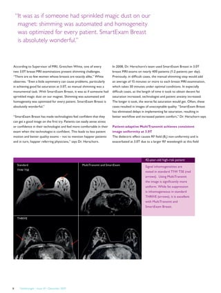 FieldStrength – Issue 39 – December 20098
According to Supervisor of MRI, Gretchen White, one of every
two 3.0T breast MRI examinations present shimming challenges.
“There are so few women whose breasts are exactly alike,” White
observes. “Even a little asymmetry can cause problems, particularly
in achieving good fat saturation at 3.0T, so manual shimming was a
monumental task. With SmartExam Breast, it was as if someone had
sprinkled magic dust on our magnet. Shimming was automated and
homogeneity was optimized for every patient. SmartExam Breast is
absolutely wonderful.”
“SmartExam Breast has made technologists feel confident that they
can get a good image on the first try. Patients can easily sense stress
or confidence in their technologist and feel more comfortable in their
exam when the technologist is confident. This leads to less patient
motion and better quality exams – not to mention happier patients
and in turn, happier referring physicians,” says Dr. Herschorn.
Standard MultiTransmit and SmartExam
“It was as if someone had sprinkled magic dust on our
magnet: shimming was automated and homogeneity
was optimized for every patient. SmartExam Breast
is absolutely wonderful.”
In 2008, Dr. Herschorn’s team used SmartExam Breast in 3.0T
breast MRI exams on nearly 400 patients (1-2 patients per day).
Previously, in difficult cases, the manual shimming step would add
an average of 15 minutes or more to each breast MRI examination,
which takes 30 minutes under optimal conditions. In especially
difficult cases, as the length of time it took to obtain decent fat
saturation increased, technologist and patient anxiety increased.
The longer it took, the worse fat saturation would get. Often, these
cases resulted in images of unacceptable quality. “SmartExam Breast
has eliminated delays in implementing fat saturation, resulting in
better workflow and increased patient comfort,” Dr. Herschorn says.
Patient-adaptive MultiTransmit achieves consistent
image uniformity at 3.0T
The dielectric effect causes RF field (B1
) non-uniformity and is
exacerbated at 3.0T due to a larger RF wavelength at this field
T1W TSE
THRIVE
42-year-old high-risk patient
Signal inhomogeneities are
noted in standard T1W TSE (red
arrows). Using MultiTransmit
the image is significantly more
uniform. While fat suppression
is inhomogeneous in standard
THRIVE (arrows), it is excellent
with MultiTransmit and
SmartExam Breast.
 