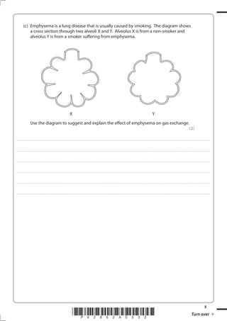 5
*P42862A0532* Turn over
(c) Emphysema is a lung disease that is usually caused by smoking. The diagram shows
a cross section through two alveoli X and Y. Alveolus X is from a non-smoker and
alveolus Y is from a smoker suffering from emphysema.
X Y
Use the diagram to suggest and explain the effect of emphysema on gas exchange.
(2)
....................................................................................................................................................................................................................................................................................
....................................................................................................................................................................................................................................................................................
....................................................................................................................................................................................................................................................................................
....................................................................................................................................................................................................................................................................................
....................................................................................................................................................................................................................................................................................
....................................................................................................................................................................................................................................................................................
 