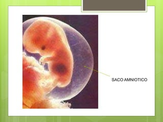 SACO AMNIOTICO
 