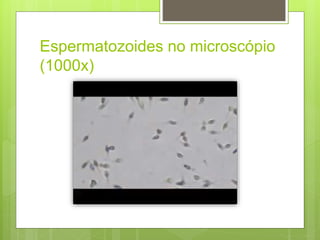 Espermatozoides no microscópio
(1000x)
 