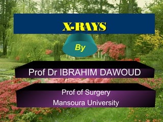 X-RAYSX-RAYS
By
Prof Dr IBRAHIM DAWOUD
Prof of Surgery
Mansoura University
 