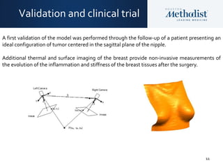 11
Validation and clinical trial
A first validation of the model was performed through the follow-up of a patient presenting an
ideal configuration of tumor centered in the sagittal plane of the nipple.
Additional thermal and surface imaging of the breast provide non-invasive measurements of
the evolution of the inflammation and stiffness of the breast tissues after the surgery.
 