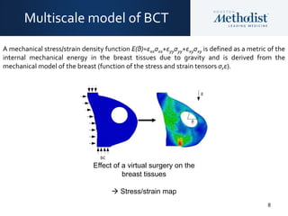 8
Multiscale model of BCT
A mechanical stress/strain density function E(θ)=εxxσxx+εyyσyy+εxyσxy is defined as a metric of the
internal mechanical energy in the breast tissues due to gravity and is derived from the
mechanical model of the breast (function of the stress and strain tensors σ,ε).
Effect of a virtual surgery on the
breast tissues
 Stress/strain map
 