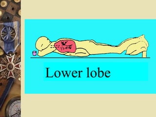 Lower lobe 