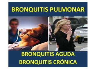 BRONQUITIS PULMONAR




  BRONQUITIS AGUDA
 BRONQUITIS CRÓNICA
 
