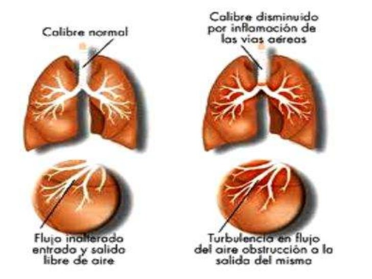 La dependencia de nicotina el tratamiento samara