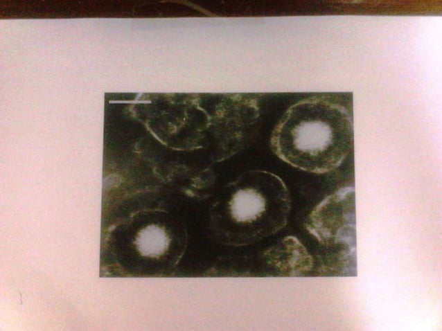 4C. VIRAL CNS INFECTIONS -POLIO, RABIES.pptx