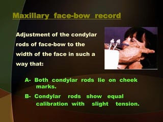 Condylar Rods 4- c Maxillo-mandibular Relation Records -Face bow record and transfer ...