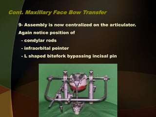 Condylar Rods 4- c Maxillo-mandibular Relation Records -Face bow record and transfer ...