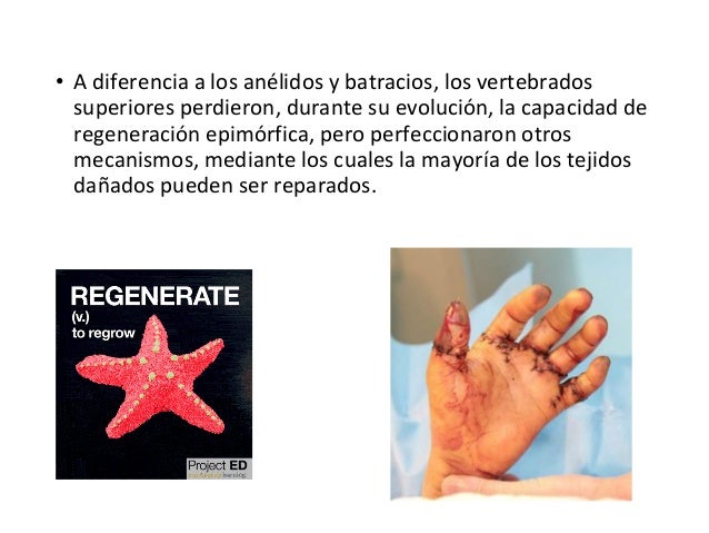 Enfermedades Osteomusculares Noticias Y Artculos