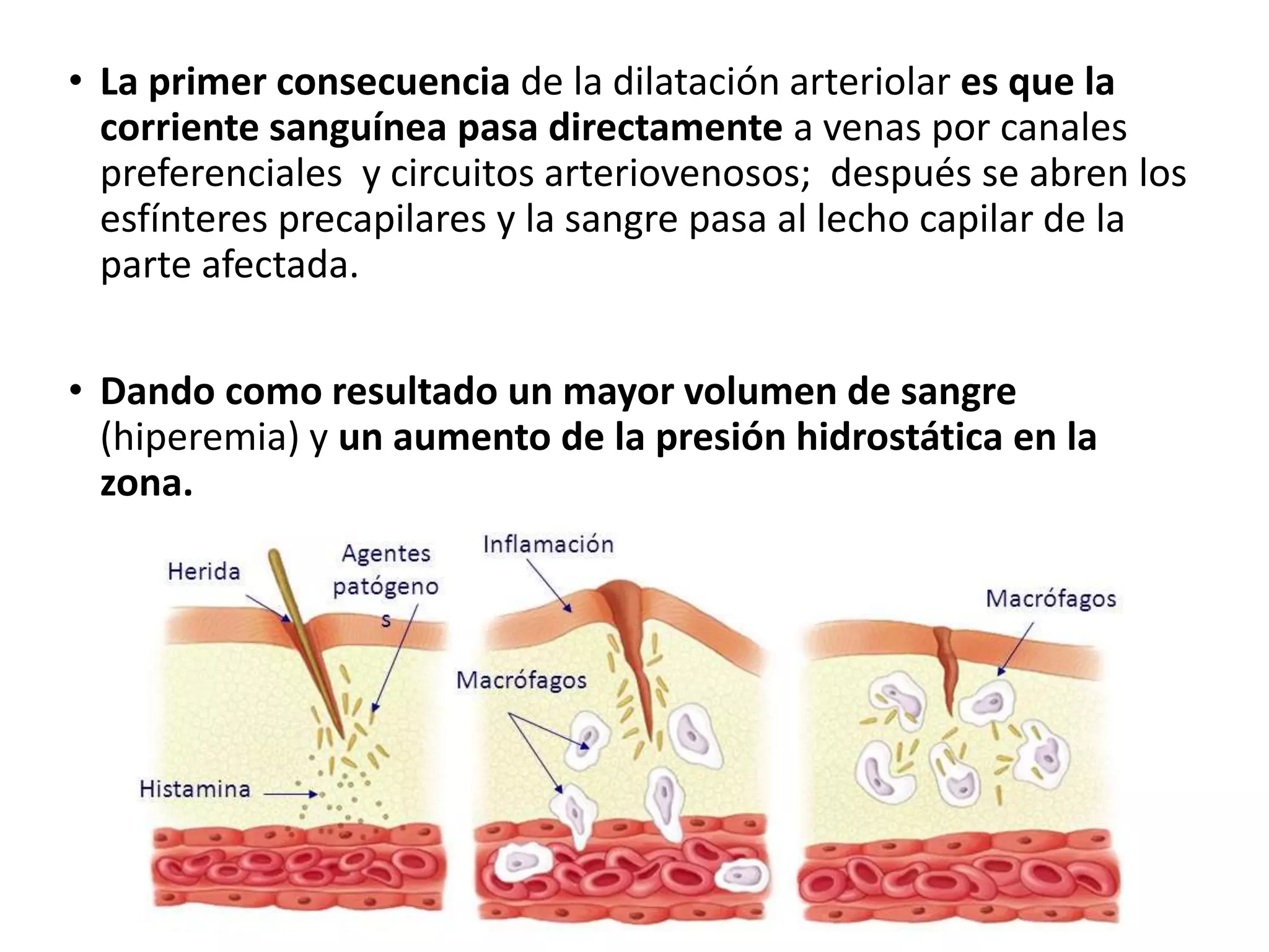 Alteraciones Vasculares En La Inflamacion PPTX alteraciones-vasculares-en-la-inflamacion-pptx