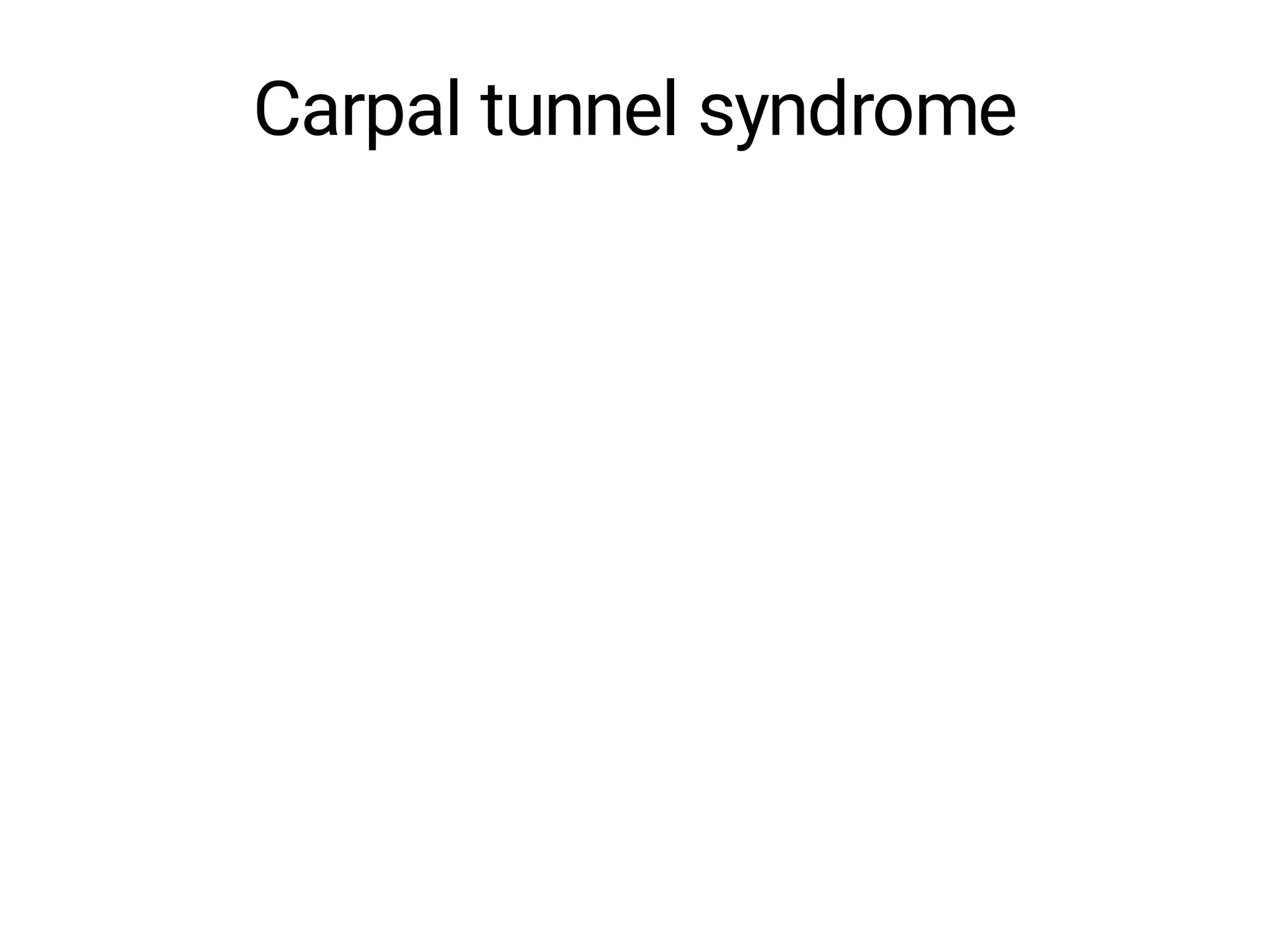 Carpal tunnel syndrome
 