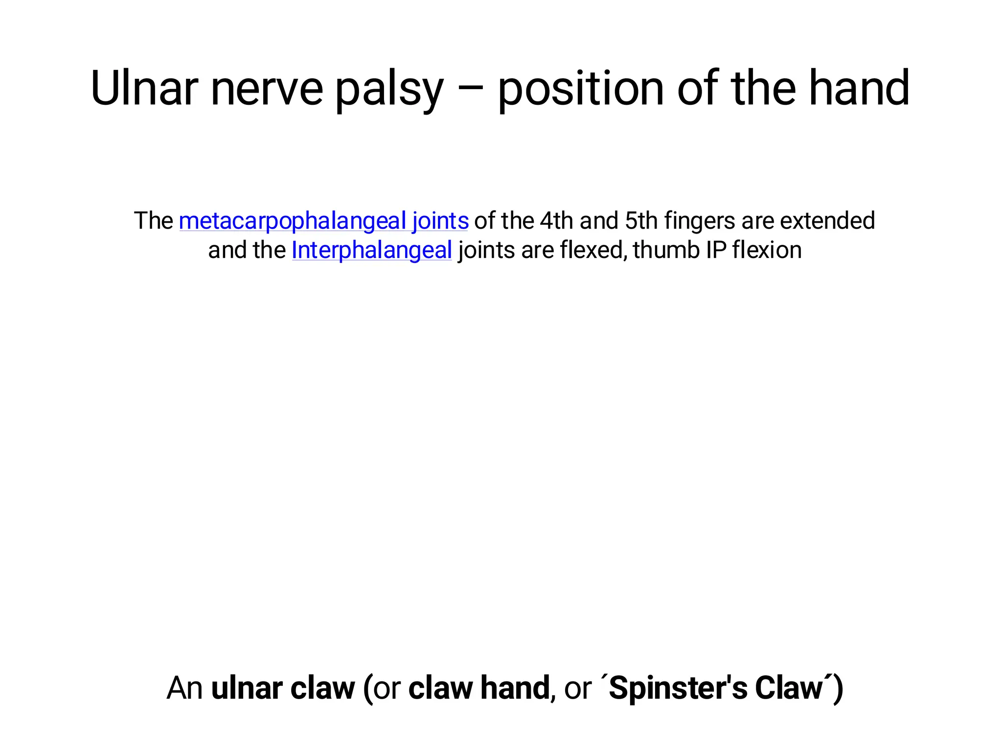 Ulnar nerve palsy – position of the hand
An ulnar claw (or claw hand, or ´Spinster's Claw´)
The metacarpophalangeal joints of the 4th and 5th fingers are extended
and the Interphalangeal joints are flexed, thumb IP flexion
 