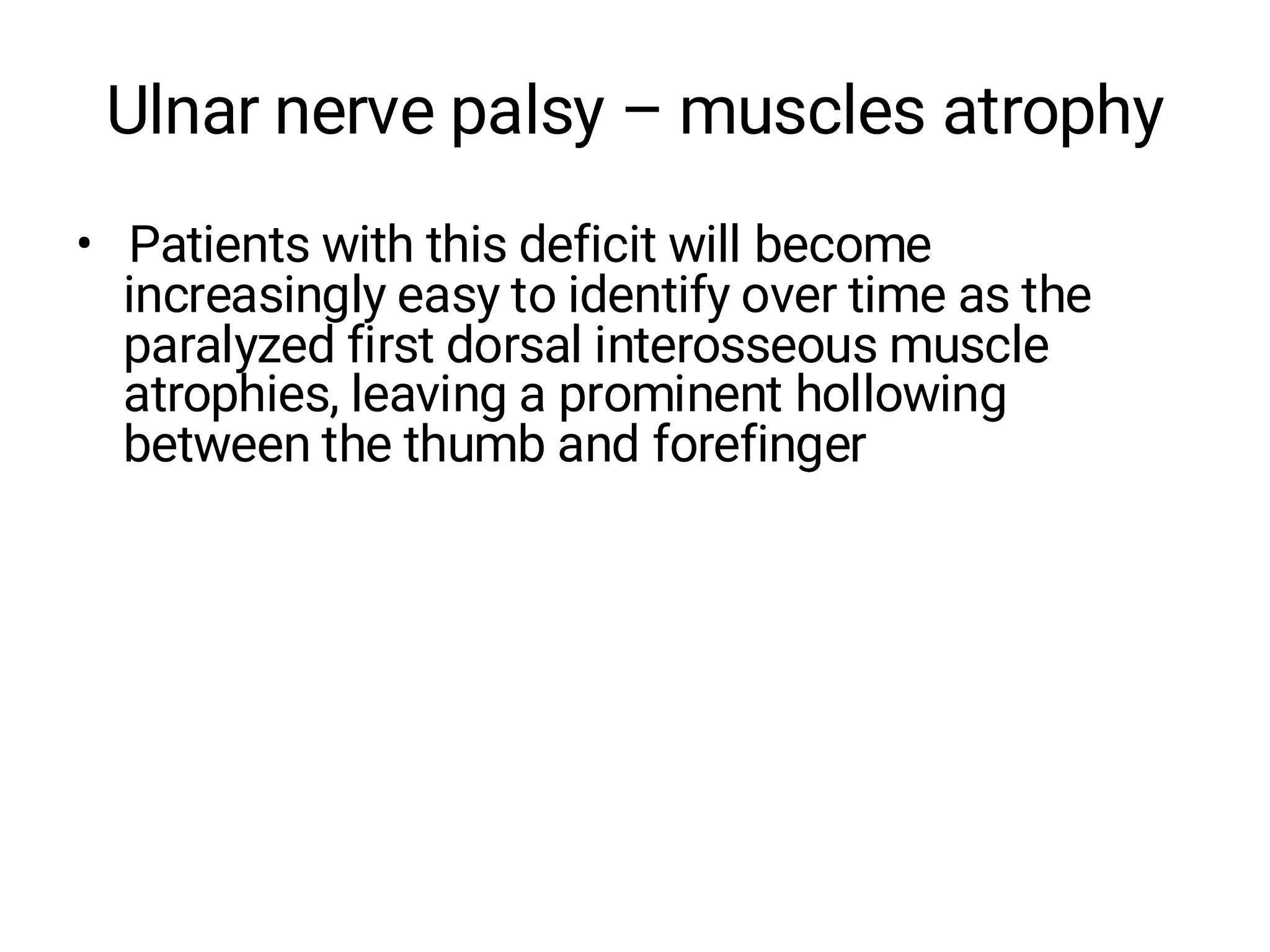 Ulnar nerve palsy – muscles atrophy
• Patients with this deficit will become
increasingly easy to identify over time as the
paralyzed first dorsal interosseous muscle
atrophies, leaving a prominent hollowing
between the thumb and forefinger
 