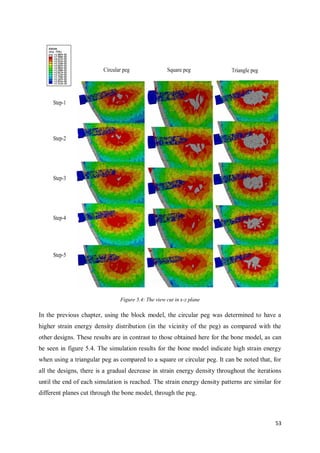 53
Figure 5.4: The view cut in x-z plane
In the previous chapter, using the block model, the circular peg was determined to have a
higher strain energy density distribution (in the vicinity of the peg) as compared with the
other designs. These results are in contrast to those obtained here for the bone model, as can
be seen in figure 5.4. The simulation results for the bone model indicate high strain energy
when using a triangular peg as compared to a square or circular peg. It can be noted that, for
all the designs, there is a gradual decrease in strain energy density throughout the iterations
until the end of each simulation is reached. The strain energy density patterns are similar for
different planes cut through the bone model, through the peg.
 