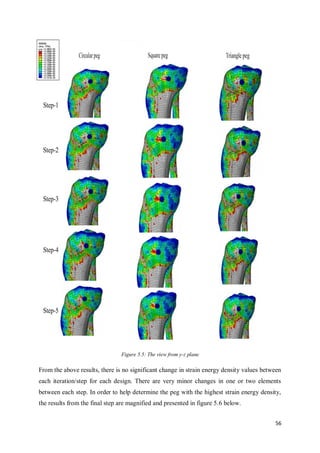 56
Figure 5.5: The view from y-z plane
From the above results, there is no significant change in strain energy density values between
each iteration/step for each design. There are very minor changes in one or two elements
between each step. In order to help determine the peg with the highest strain energy density,
the results from the final step are magnified and presented in figure 5.6 below.
 