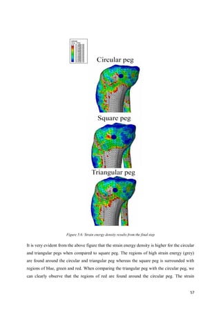 57
Figure 5.6: Strain energy density results from the final step
It is very evident from the above figure that the strain energy density is higher for the circular
and triangular pegs when compared to square peg. The regions of high strain energy (grey)
are found around the circular and triangular peg whereas the square peg is surrounded with
regions of blue, green and red. When comparing the triangular peg with the circular peg, we
can clearly observe that the regions of red are found around the circular peg. The strain
 