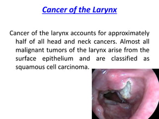 Cancer of the Larynx
Cancer of the larynx accounts for approximately
half of all head and neck cancers. Almost all
malignant tumors of the larynx arise from the
surface epithelium and are classified as
squamous cell carcinoma.
 