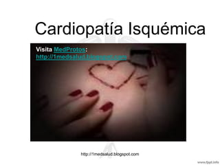 Cardiopatía Isquémica
Visita MedProtos:
http://1medsalud.blogspot.com




              http://1medsalud.blogspot.com
 