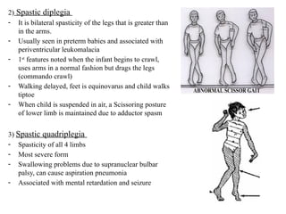 Spastic Posture 4)_Cerebral_Palsy mbbs undergraduate.pptx