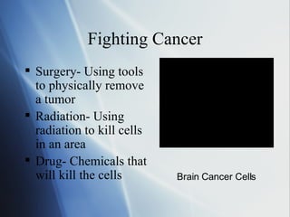 Fighting Cancer Surgery- Using tools to physically remove a tumor Radiation- Using radiation to kill cells in an area Drug- Chemicals that will kill the cells Brain Cancer Cells 