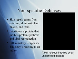 Non-specific Defenses Skin repels germs from entering, along with hair, mucus, and tears Interferon- a protein that inhibits protein synthesis and viral reproduction Inflammatory Response-The body’s reacting to an injury A cell nucleus infected by an unidentified disease 