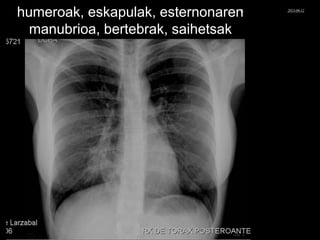 humeroak, eskapulak, esternonaren
manubrioa, bertebrak, saihetsak
© Xabier Zupiria, Andoni Bueno2013-06-12
 