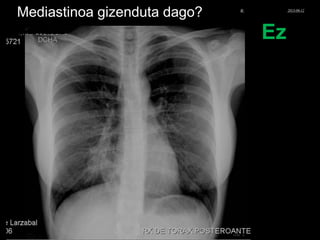 Mediastinoa gizenduta dago?
Ez
© Xabier Zupiria, Andoni Bueno2013-06-12
 