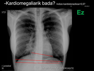 -Kardiomegaliarik bada? Indize kardiotorazikoa>0,5?
Ez
© Xabier Zupiria, Andoni Bueno2013-06-12
 