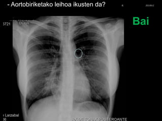 - Aortobiriketako leihoa ikusten da?
Bai
© Xabier Zupiria, Andoni Bueno2013-06-12
 