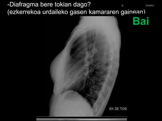 -Diafragma bere tokian dago?
(ezkerrekoa urdaileko gasen kamararen gainean)
Bai
© Xabier Zupiria, Andoni Bueno2013-06-12
 