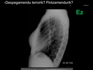 -Despegamendu lerrorik? Pintzamendurik?
Ez
© Xabier Zupiria, Andoni Bueno2013-06-12
 