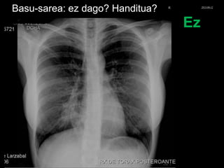 Basu-sarea: ez dago? Handitua?
Ez
© Xabier Zupiria, Andoni Bueno2013-06-12
 
