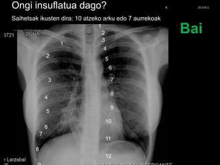 Ongi insuflatua dago?
Saihetsak ikusten dira: 10 atzeko arku edo 7 aurrekoak
1
2
3
4
5
6
7
8
9
10
11
Bai
12
1
2
3
4
5
6
7
8
© Xabier Zupiria, Andoni Bueno2013-06-12
 