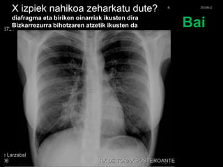 X izpiek nahikoa zeharkatu dute?
diafragma eta biriken oinarriak ikusten dira
Bizkarrezurra bihotzaren atzetik ikusten da Bai
© Xabier Zupiria, Andoni Bueno2013-06-12
 