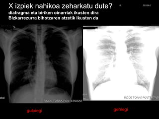 X izpiek nahikoa zeharkatu dute?
diafragma eta biriken oinarriak ikusten dira
Bizkarrezurra bihotzaren atzetik ikusten da
gutxiegi gehiegi
© Xabier Zupiria, Andoni Bueno2013-06-12
 