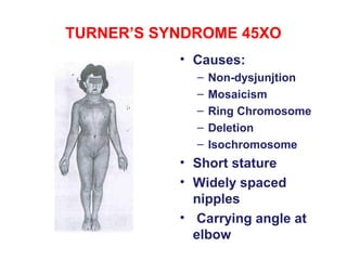 4 chromosomal aberrations ks | PPT