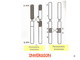 4 chromosomal aberrations ks | PPT