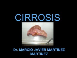 CIRROSIS
Dr. MARCIO JAVIER MARTINEZ
MARTINEZ
 