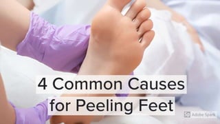 4 common causes for peeling feet