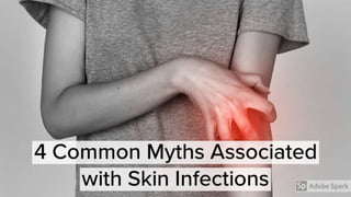 4 common myths associated with skin infection