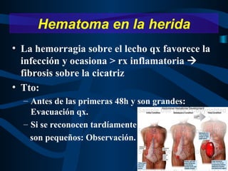 La hemorragia sobre el lecho qx favorece la infección y ocasiona > rx inflamatoria    fibrosis sobre la cicatriz Tto: Antes de las primeras 48h y son grandes: Evacuación qx. Si se reconocen tardíamente o  son pequeños: Observación. Hematoma en la herida 