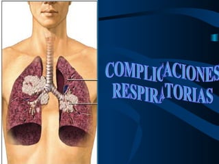 COMPLICACIONES RESPIRATORIAS 