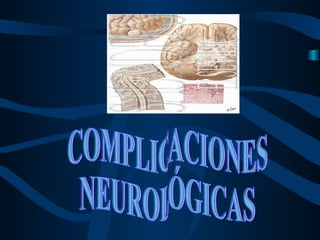 COMPLICACIONES  NEUROLÓGICAS 