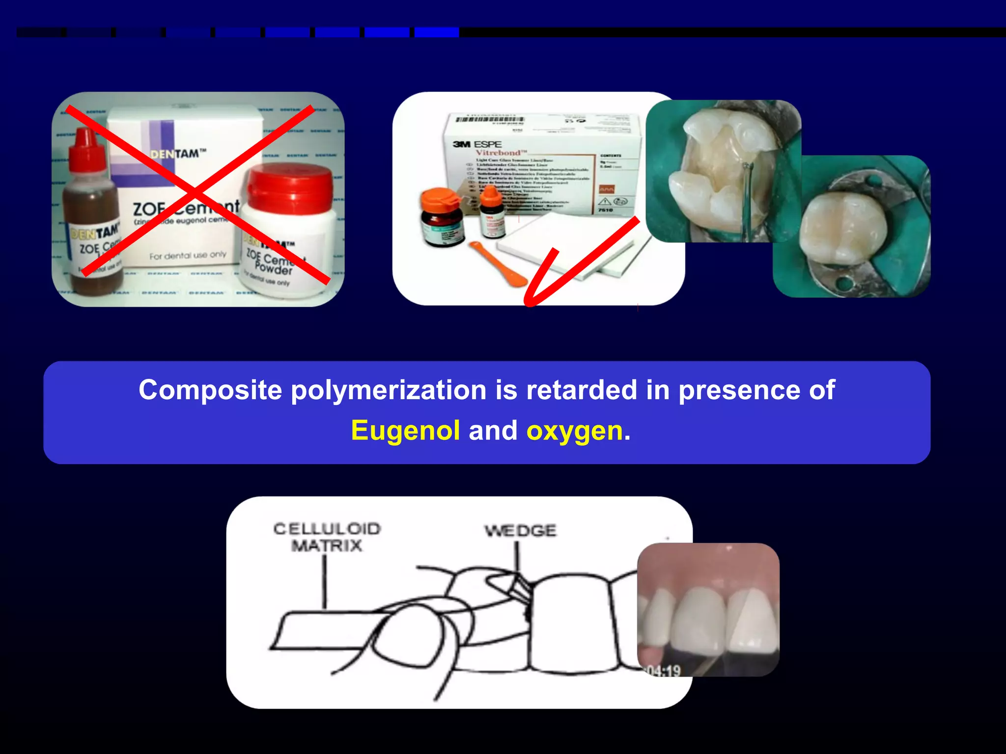 composite resin dental material